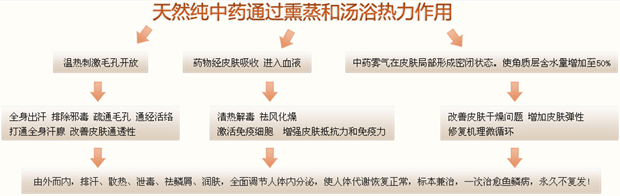 鱼鳞病治疗