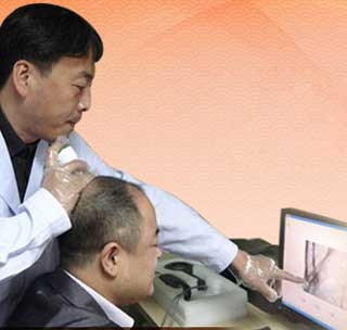 严重掉头发是怎么回事